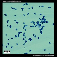 staphylococcus epidermidis microscopy